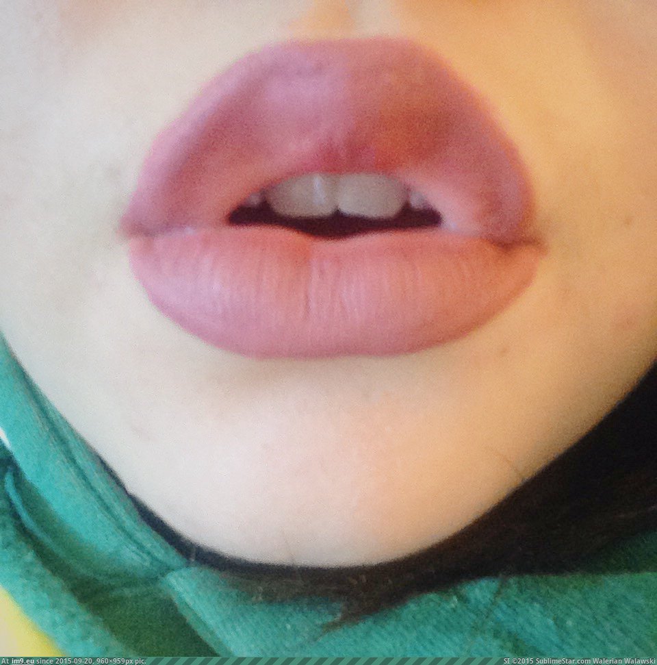 lovley lips (49) (in I Love Lips)