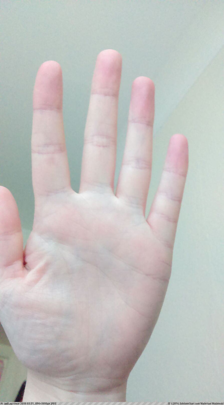 [Mildlyinteresting] My sister has an extra crease on her little finger (in My r/MILDLYINTERESTING favs)