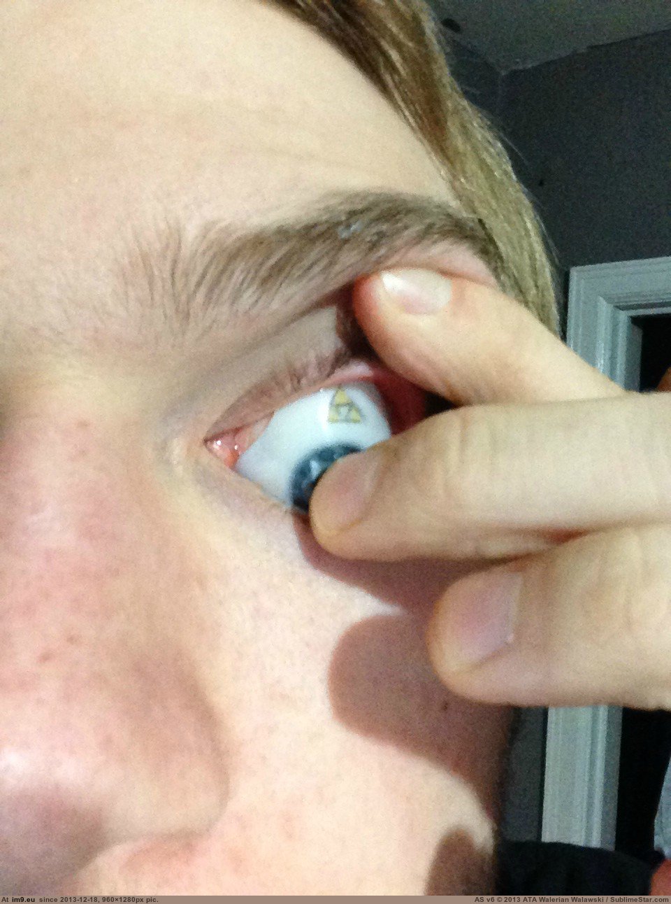 taking out my prosthetic eye and showing you what's behind it 