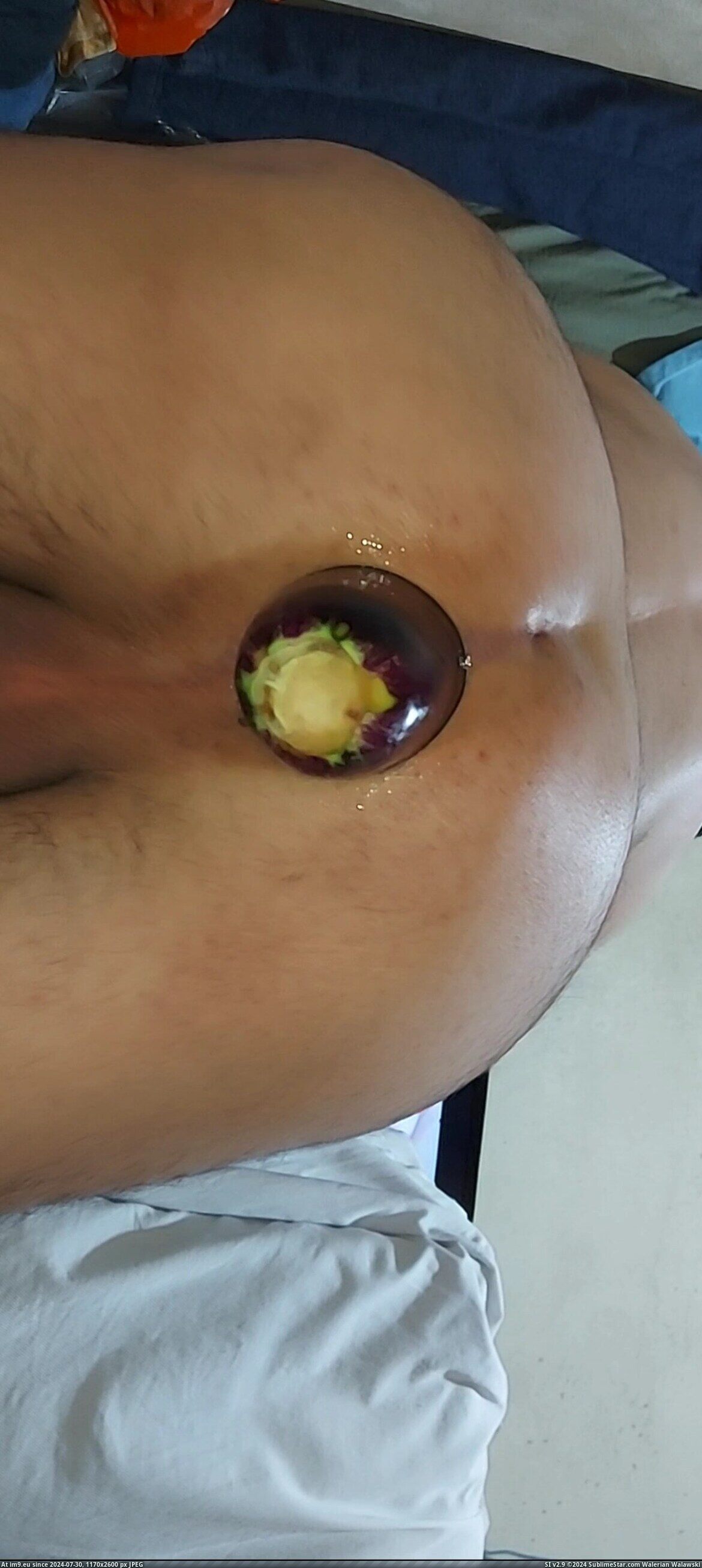 #Gay #Asshole #Hole #Snapshot #Cock #Dick 20240723_113329.mp4_snapshot_01.00.256 Pic. (Image of album so de quatro))