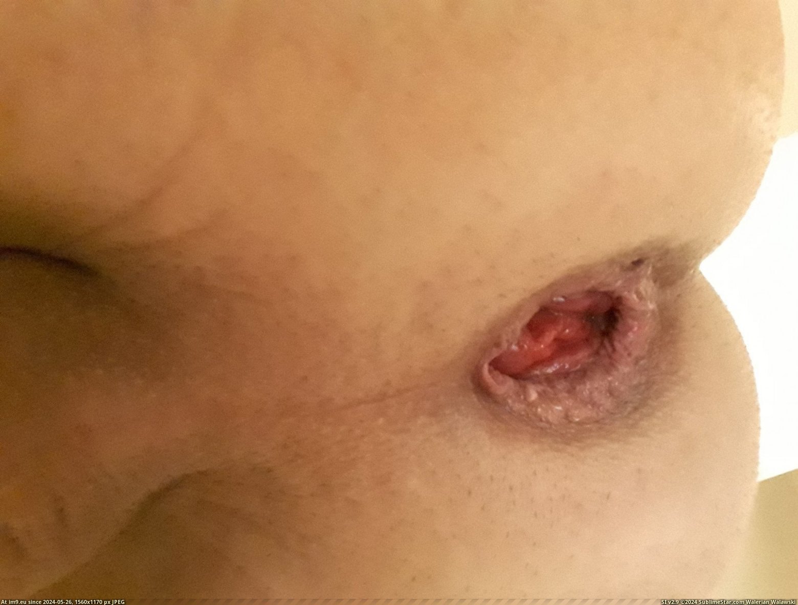 #Gay #Faggot #Fag esTiE63e Pic. (Image of album Fariss Von Rundstedt))