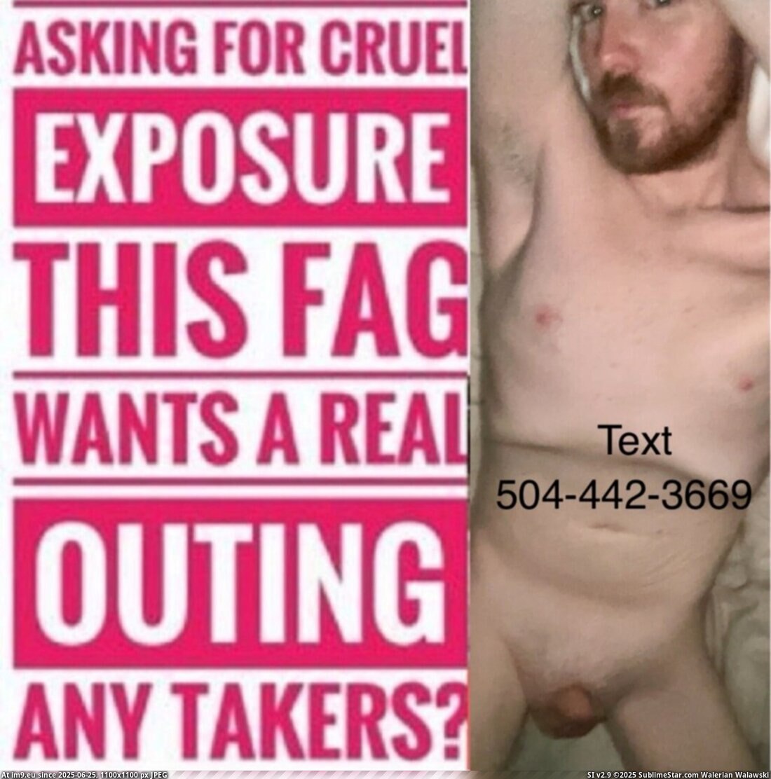 Fag Joseph Lee (in Instant Upload)