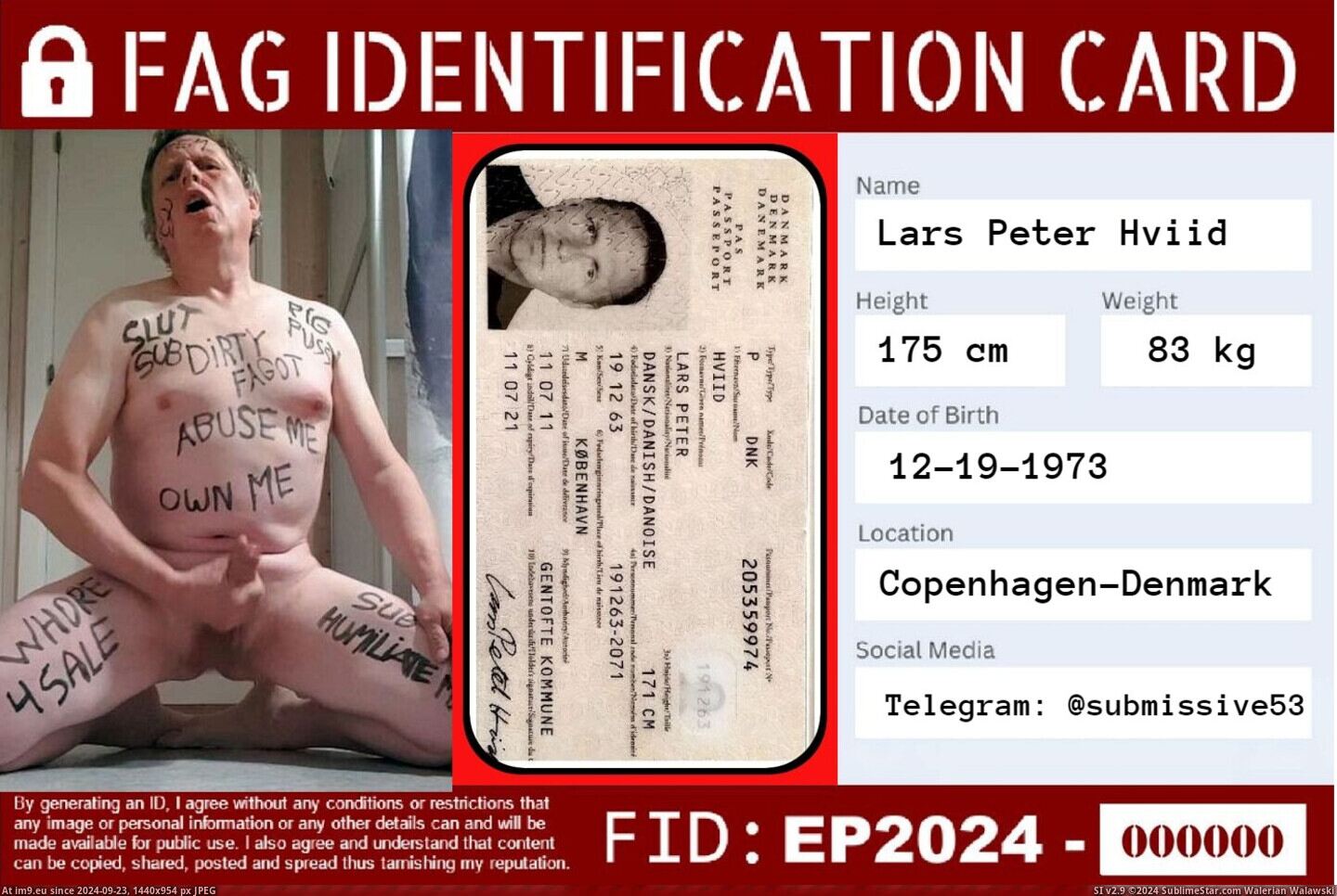#Exposed #Hard #Hviid #Lars #Fag #Exposure Fag Lars Hviid exposed (4) Pic. (Image of album Faggot Lars Hviid - hard exposure))