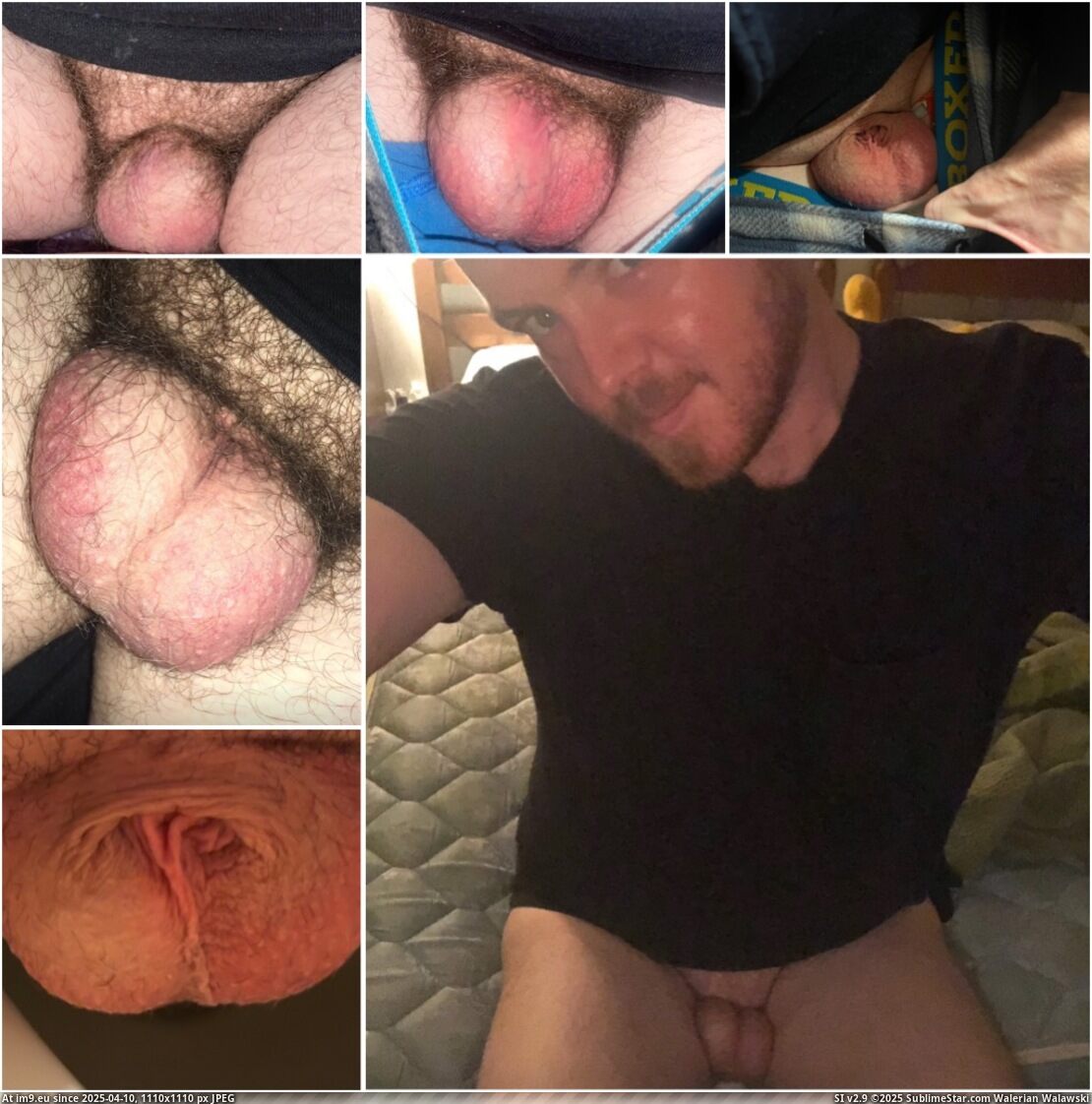 #Slut #Whore #Fag #Penectomy #Cumdump #Bitch #Faggot #Dickless IMG_1694 Pic. (Obraz z album Instant Upload))
