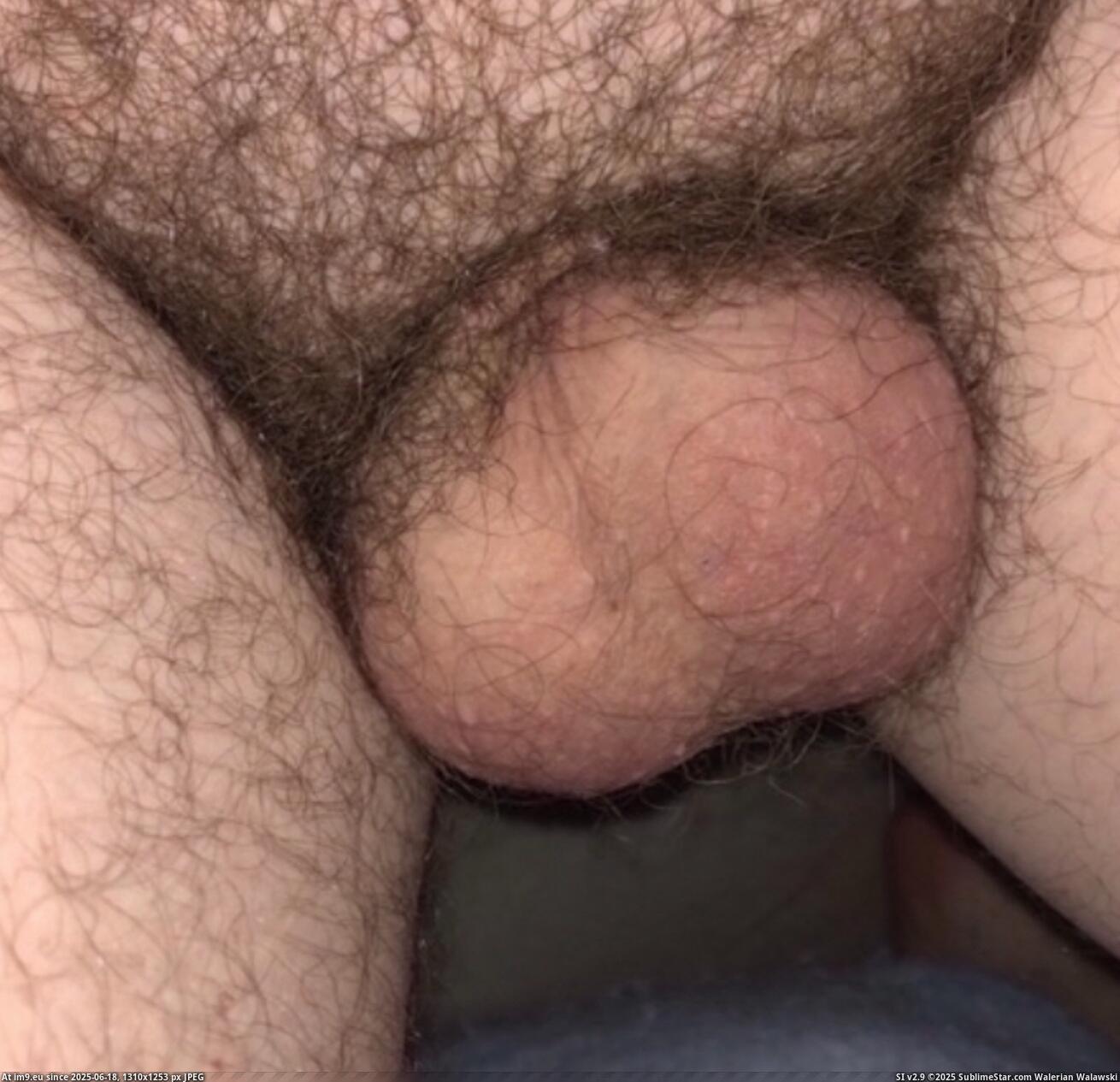 #Fag #Faggot #Penis #Bend #Joseph #Ray #Dickless IMG_6541 Pic. (Image of album Dickless Fag - banding penis ruined it.))