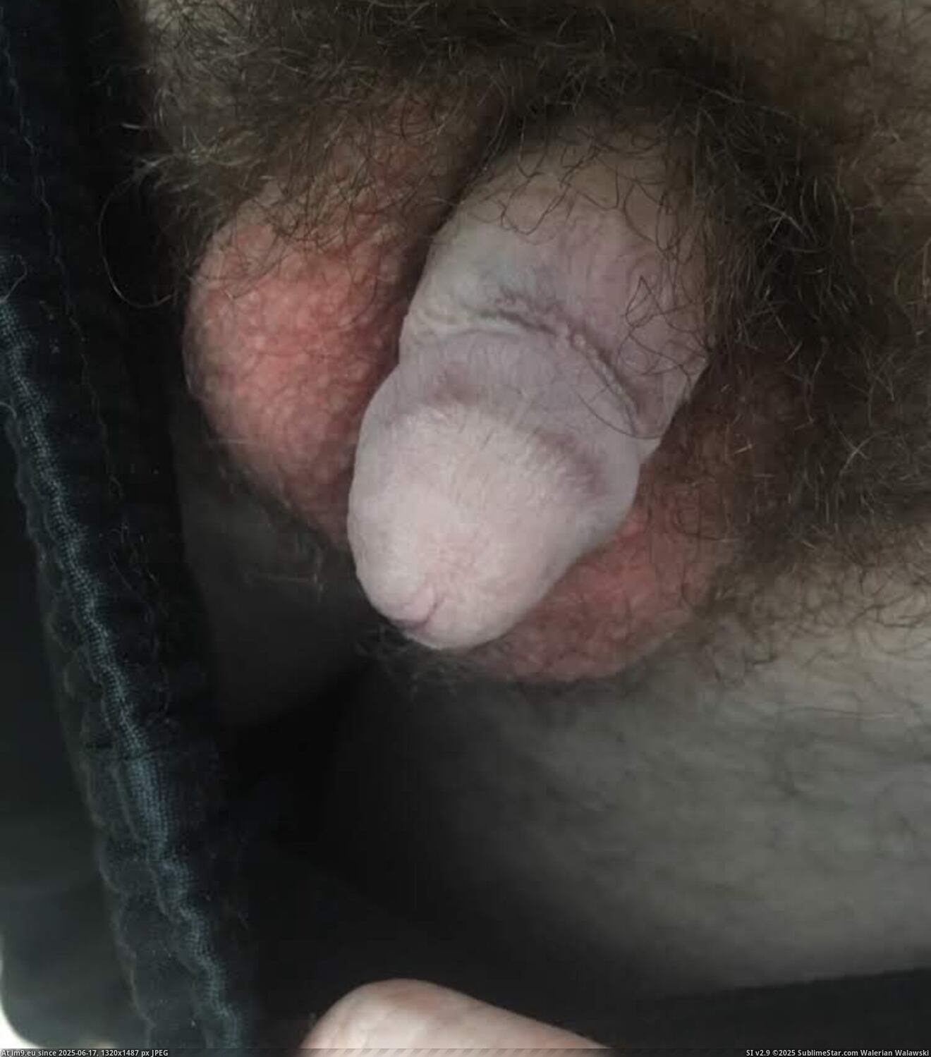 #Gay #Exposed #Fag #Penectomy #Lee #Joseph #Humiliated #Ray #Faggot #Dickless IMG_6737 Pic. (Image de album Dickless Fag Joseph Ray Lee))