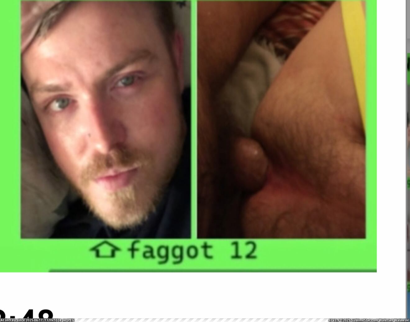 #Gay #Exposed #Fag #Penectomy #Lee #Joseph #Humiliated #Ray #Faggot #Dickless IMG_6954 Pic. (Image of album Dickless Fag Joseph Ray Lee))