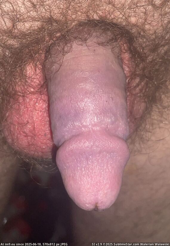 #Fag #Faggot #Lee #Bend #Joseph #Dickless #Point IMG_7247 Pic. (Image of album Dickless Fag - banding penis ruined it.))