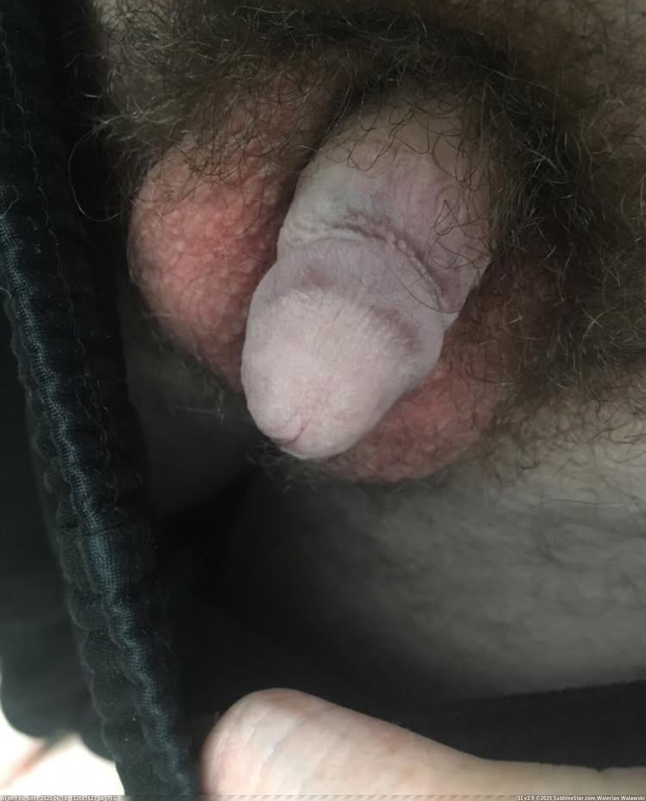 #Fag #Faggot #Ray #Lee #Bend #Dickless #Penis #Point IMG_7260 Pic. (Image of album Dickless Fag - banding penis ruined it.))