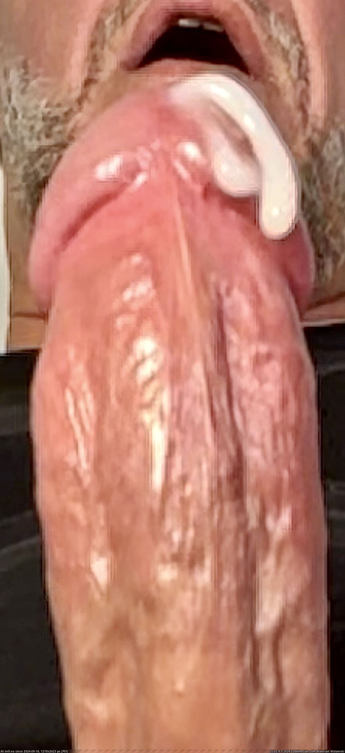 #Cum #Gay #Sperm #Swallow #Anus #Suck #Circle #Empty IMG_9831 Pic. (Image of album Squirting penis))