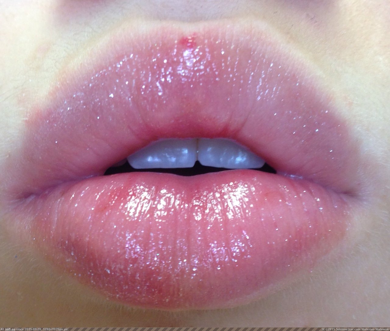 lovley lips (30) (in I Love Lips)