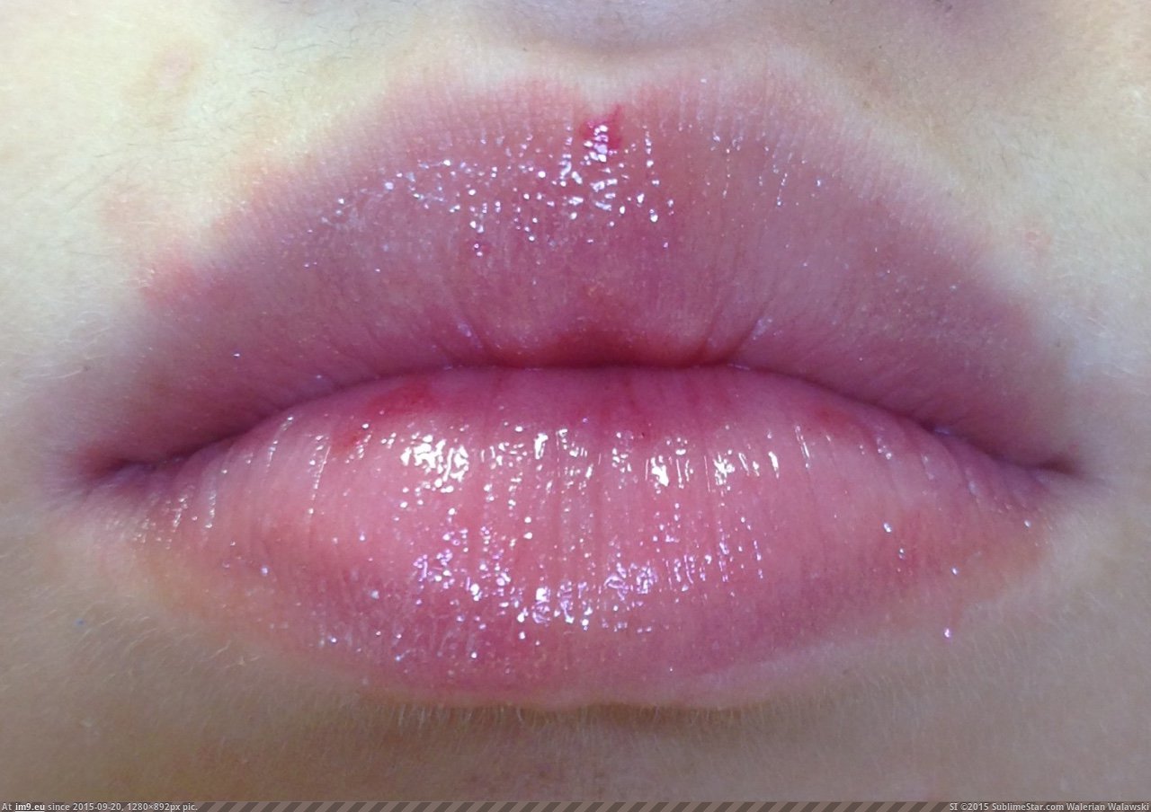 lovley lips (31) (in I Love Lips)