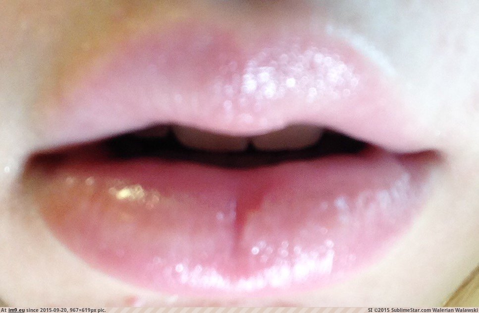 lovley lips (57) (in I Love Lips)