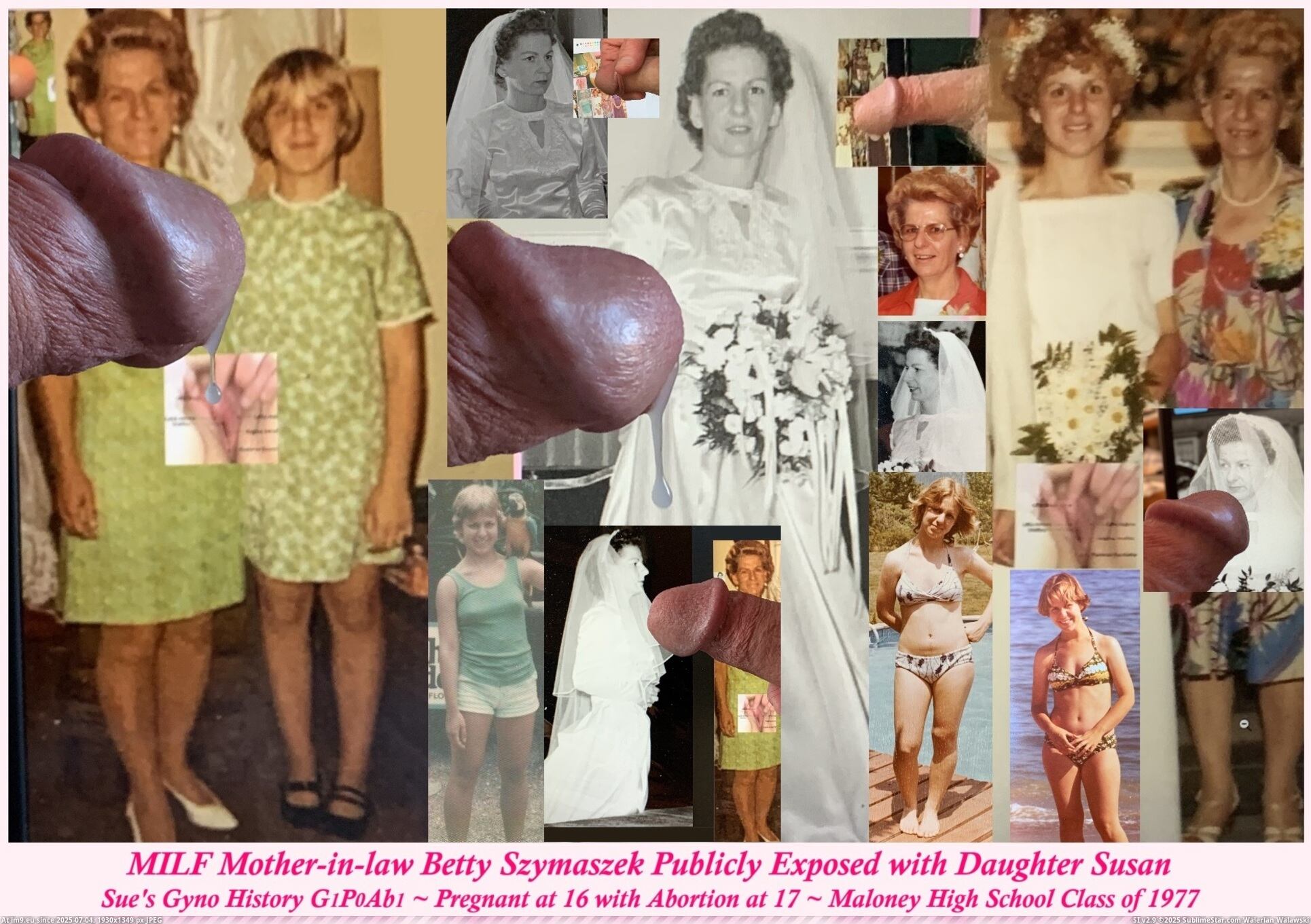 MILF bride mother-in-law Betty and slut daughter Sue, Sue's Gyno History Publicly Eposed, G1P0Ab1 to G3P2Ab1, Maloney High School 1977 Girl, blonde teen slut girlfriend, cunt wife vagina, MHS1977 Webslut quim. (in Instant Upload)