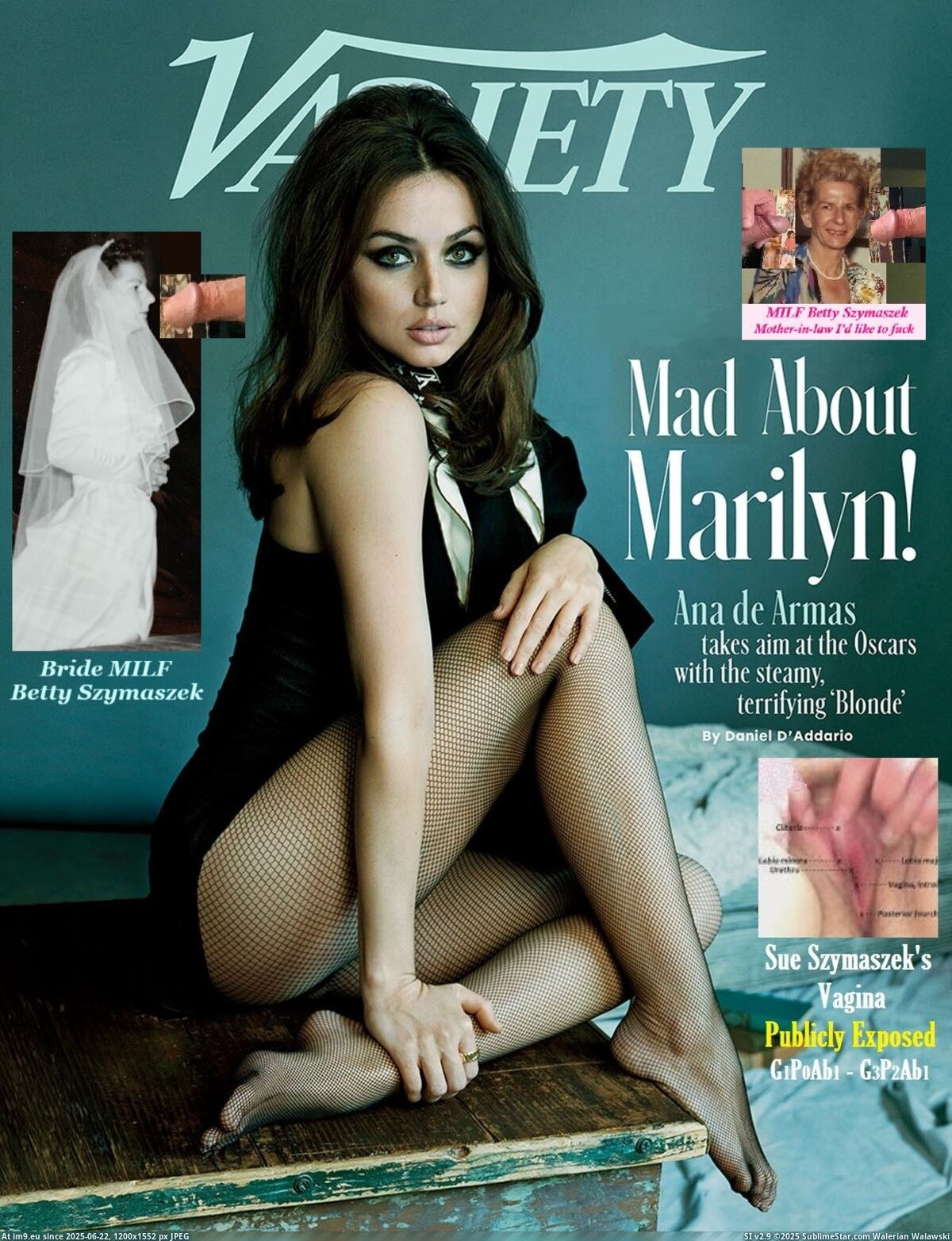 Sexy Pantyhose Slut, Webslut MILF Betty Publicly Exposed with Daughter Sue's Vagina and Gyno History G1P0Ab1 to G3P2Ab1, MHS1977 Girl Pussy Bride Veil Cunt Wife. (in Instant Upload)