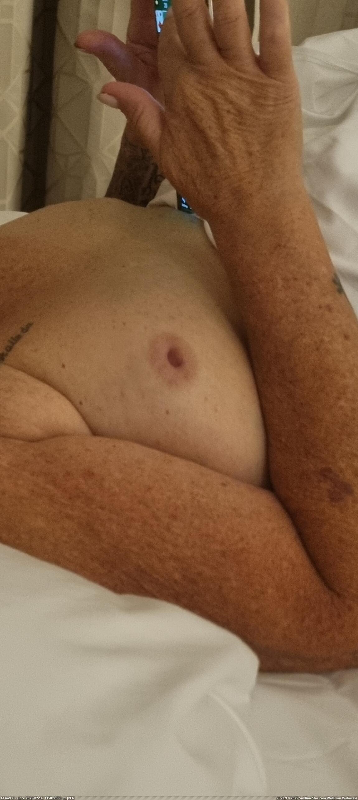 #Image #Tittie #Soft soft tittie Pic. (Image of album Instant Upload))