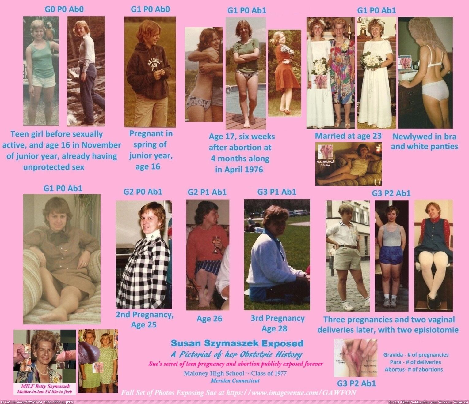 Sueszy Publicly Exposed, A Pictorial of her Gyno History G1P0Ab1 to G3P2Ab1, Maloney High School Class of 1977 Girl Teen Pregnancy Slut Girlfriend Vagina Bride Pussy Wife Cunt MILF Webslut MHS1977. (in Instant Upload)