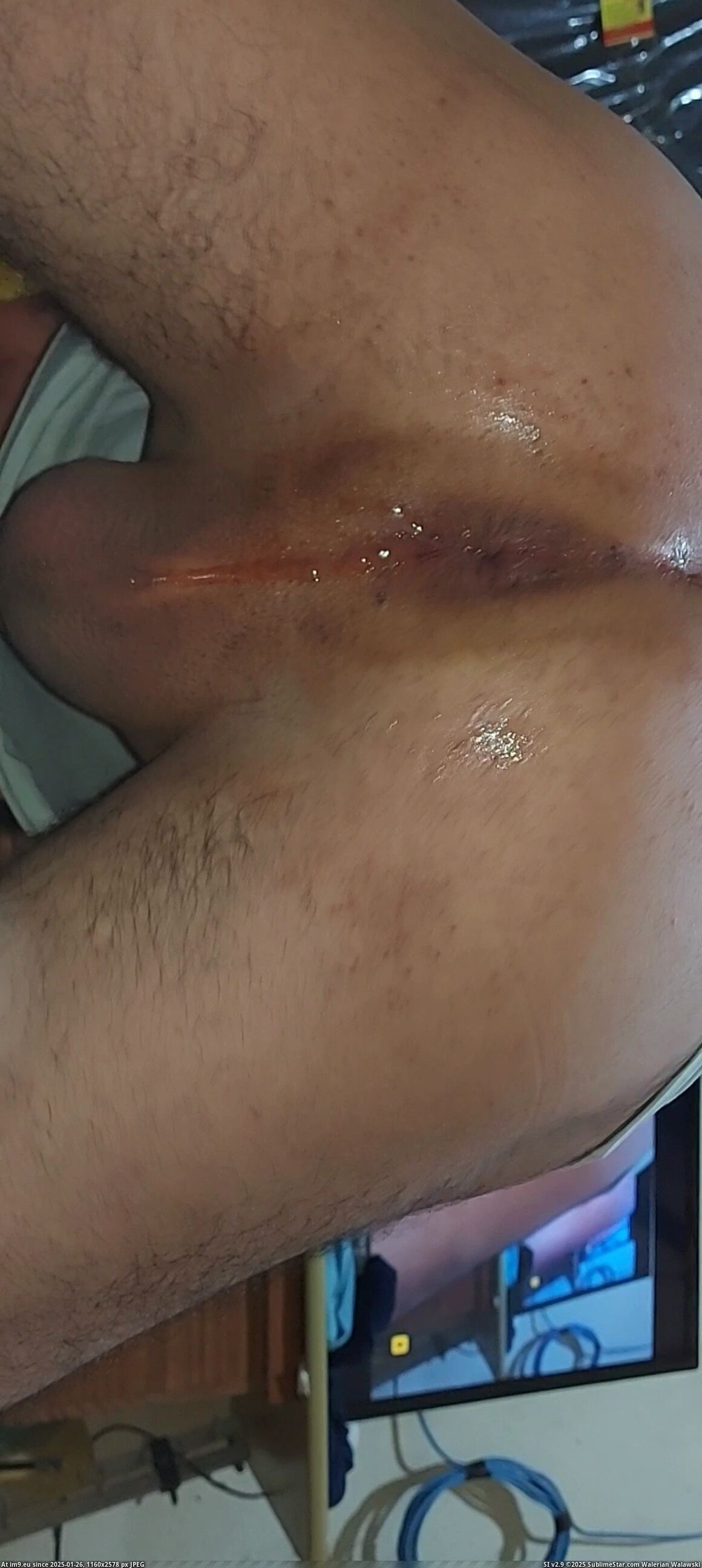 #Porn #Hardcore #Gay #Dirty #Hole #Videocapture #Gayasshole #Asshole #Cock #Dick VideoCapture_20231003-010147 Pic. (Imagen de album so de quatro))
