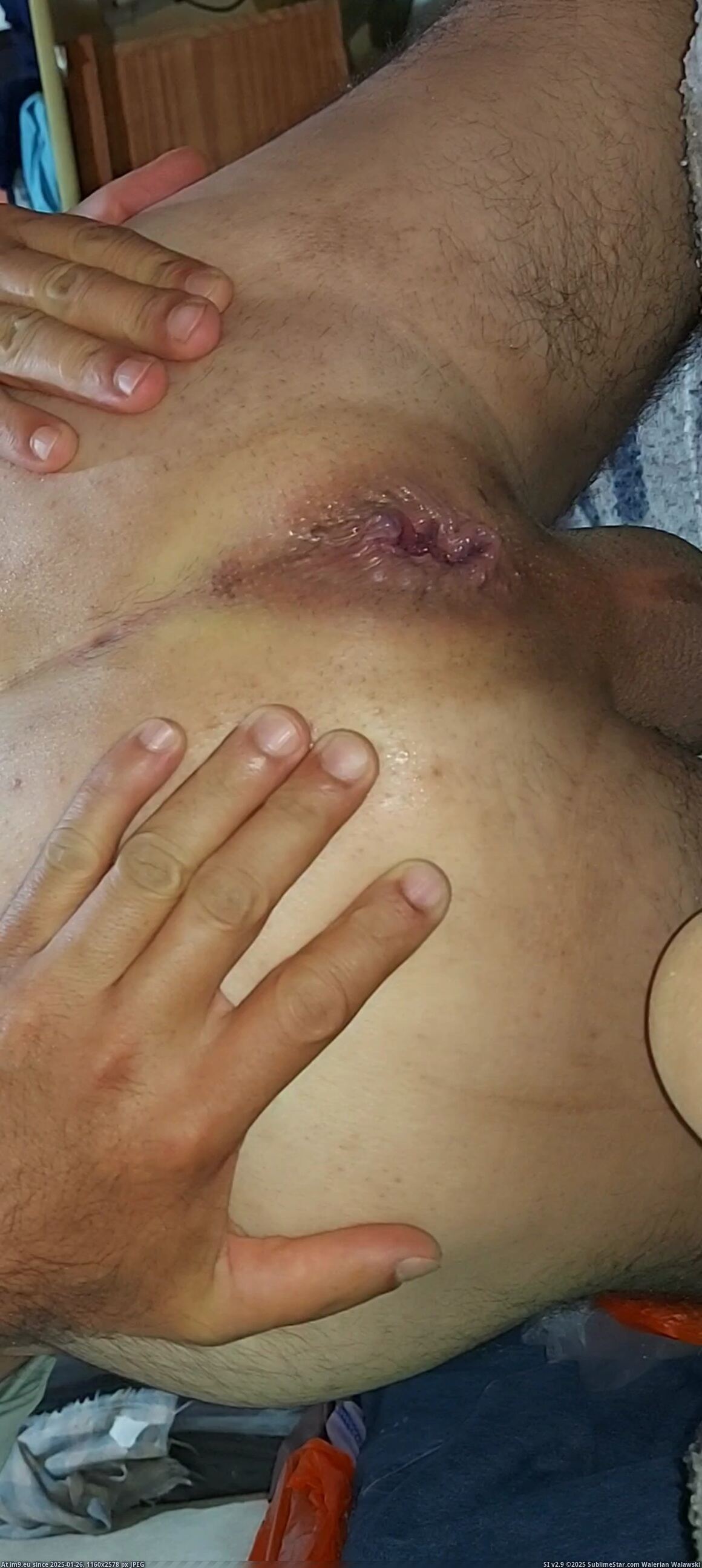 #Xxx #Hardcore #Gay #Fucking #Hole #Videocapture #Gayasshole #Asshole #Cock #Dick #Dirty VideoCapture_20231003-010907 Pic. (Image of album so de quatro))