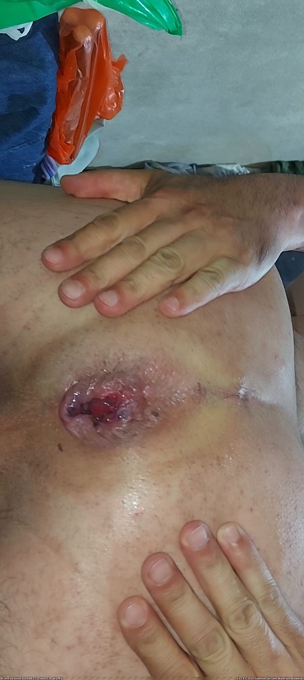 #Porn #Xxx #Fucking #Asshole #Filthy #Videocapture #Gayasshole #Cock #Dick #Dirty #Hole VideoCapture_20231004-015917 Pic. (Bild von album so de quatro))