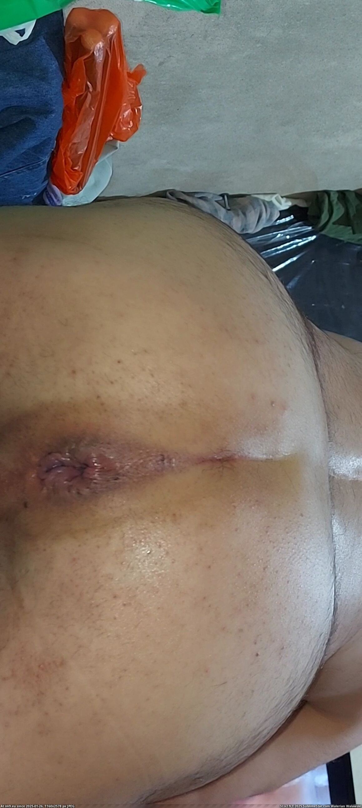 #Xxx #Hardcore #Fucking #Asshole #Fag #Videocapture #Gayasshole #Cock #Dick #Dirty #Hole VideoCapture_20231004-020221 Pic. (Imagen de album so de quatro))