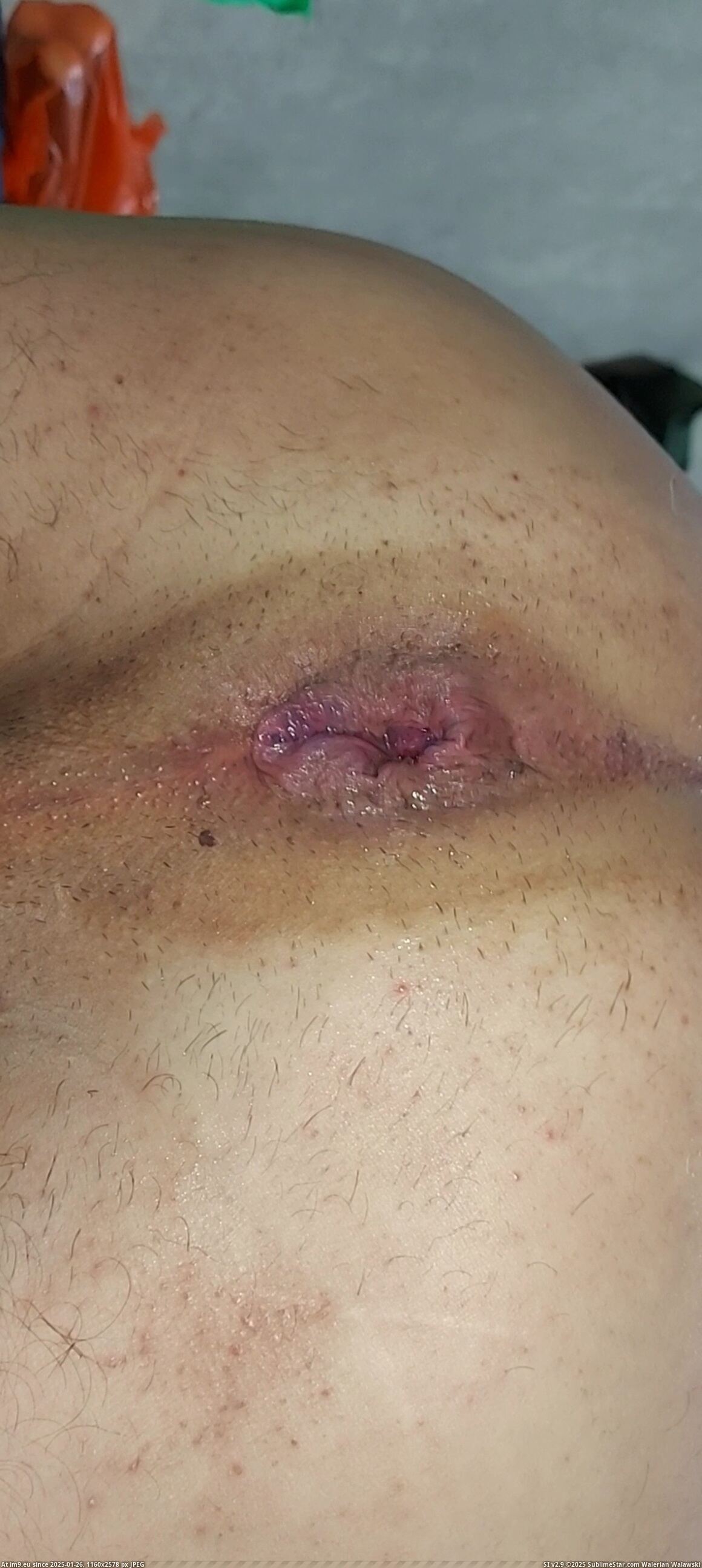 #Xxx #Hardcore #Gay #Asshole #Filthy #Videocapture #Gayasshole #Cock #Dick #Hole #Fag VideoCapture_20231004-020739 Pic. (Image of album so de quatro))