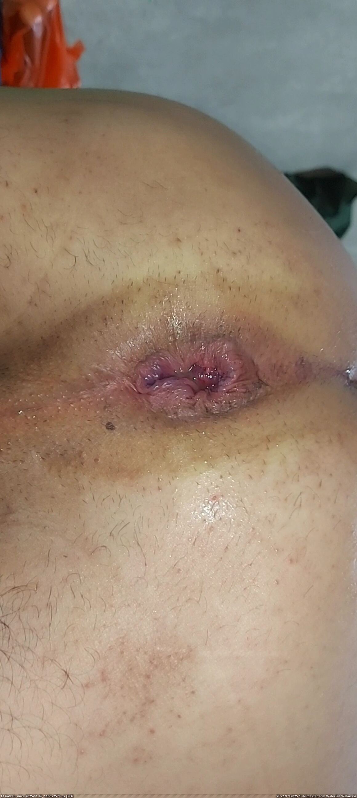 #Porn #Gay #Fucking #Asshole #Filthy #Videocapture #Gayasshole #Cock #Dick #Dirty #Fag VideoCapture_20231004-020847 Pic. (Image of album so de quatro))