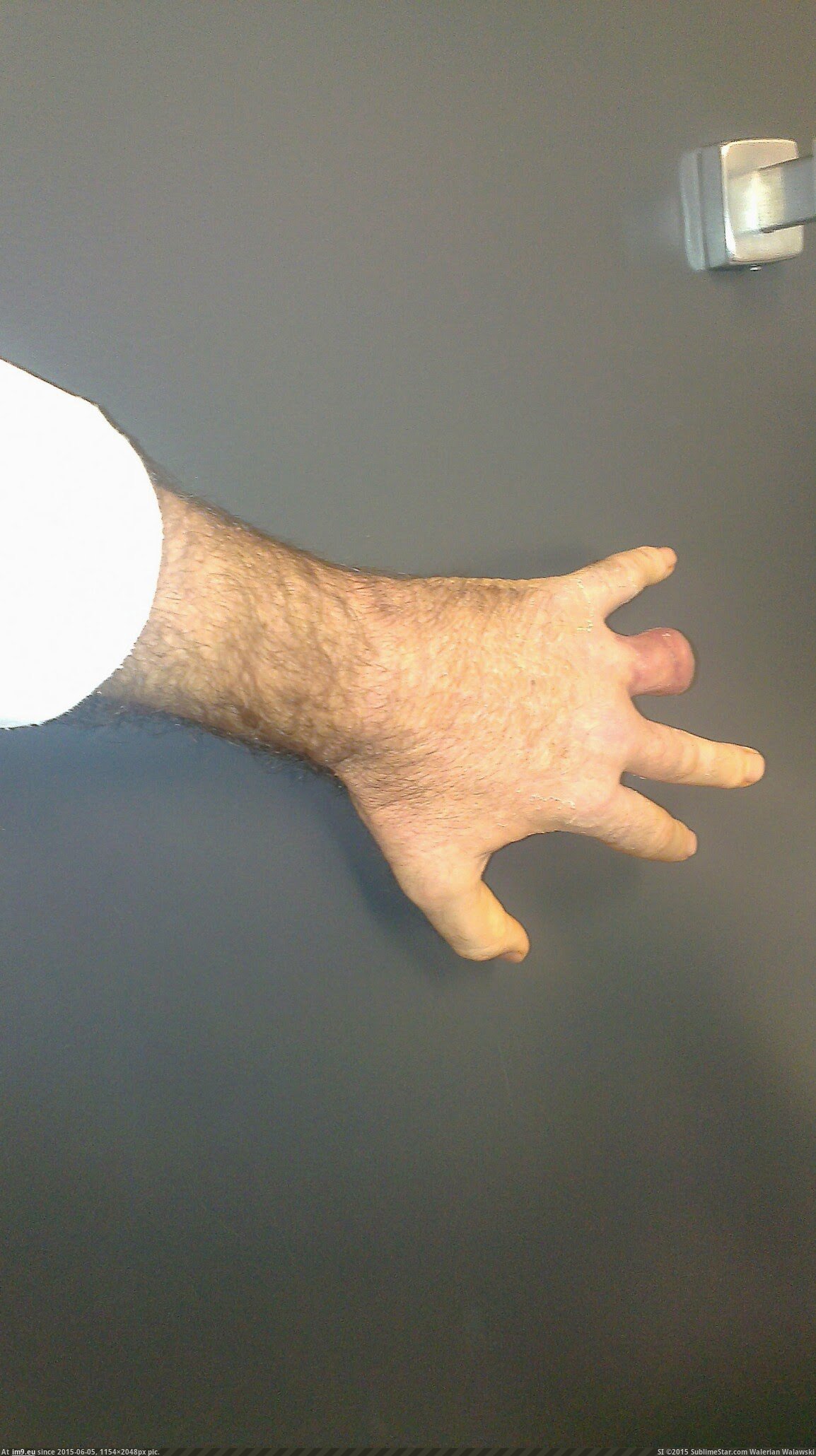 [Wtf] Hard Core Hand Gore 1 (in My r/WTF favs)