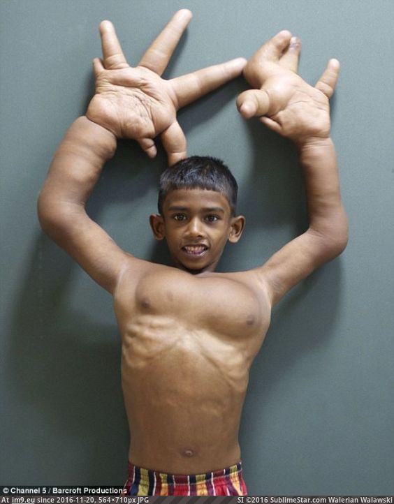 [Wtf] Meet The Amazing Boy With The World's BIGGEST Hands (in My r/WTF favs)