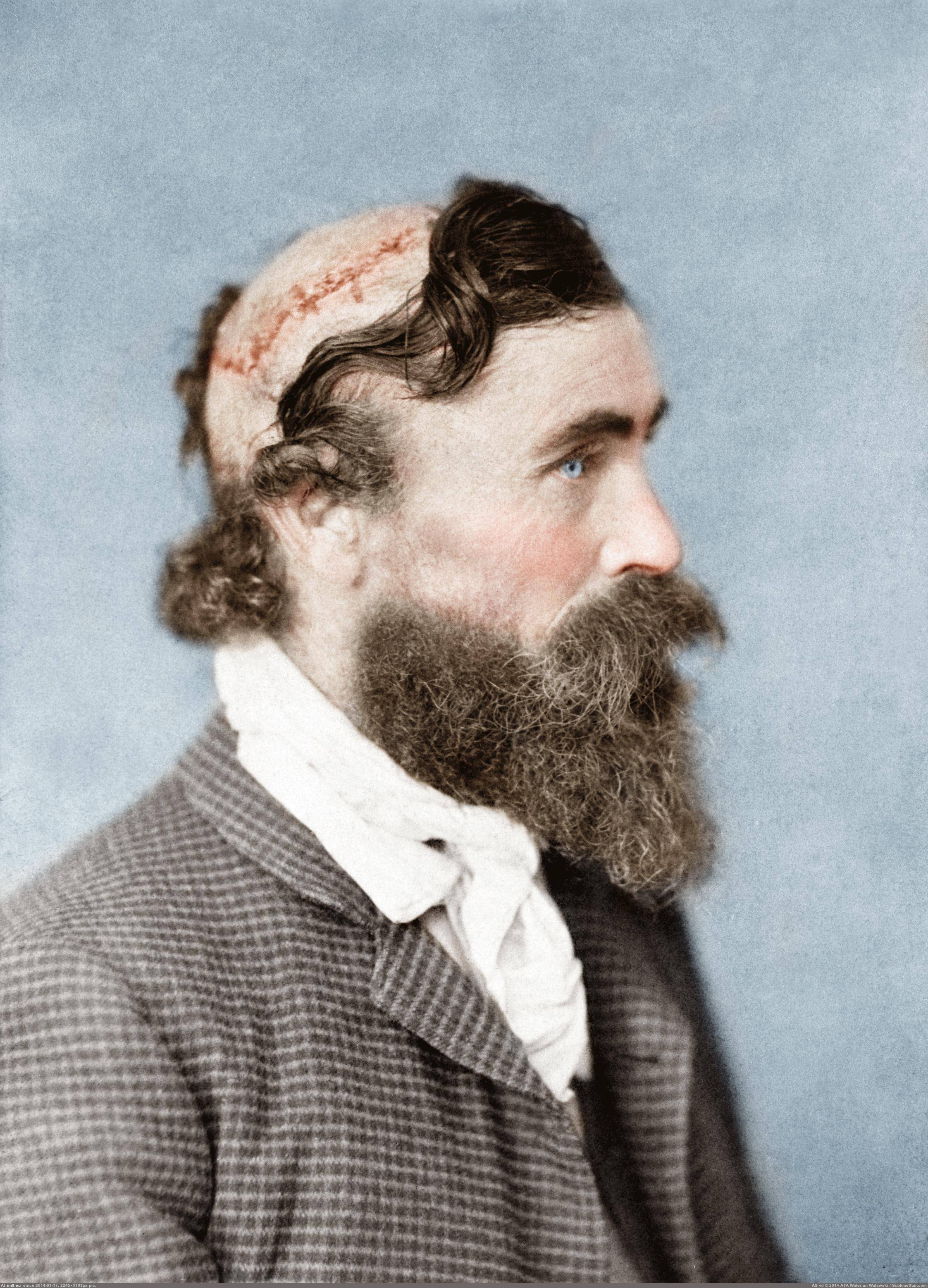 [Wtf] Robert McGee, a man who was scalped as a child by the Sioux Chief Little Turtle, 1864 (in My r/WTF favs)
