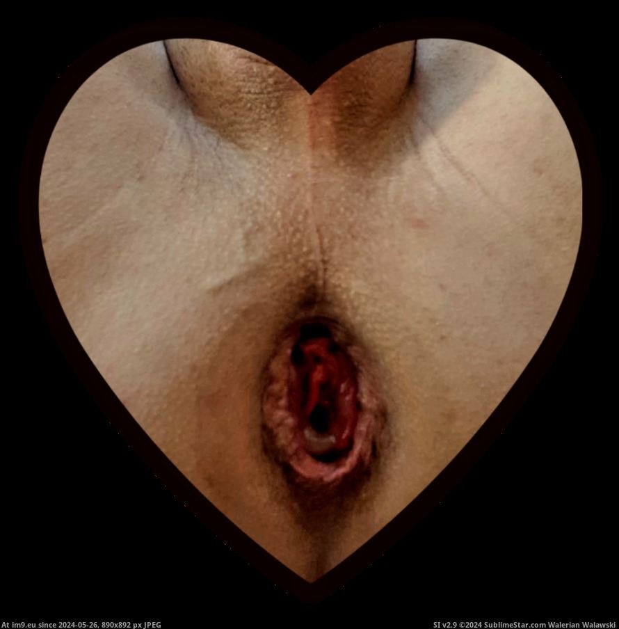 #Gay #Faggot #Fag ztLT4ceH Pic. (Image of album Fariss Von Rundstedt))