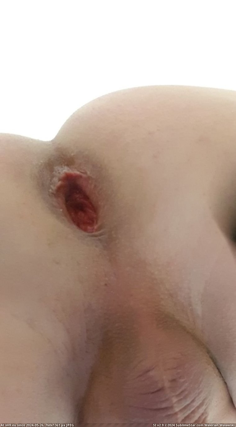 #Gay #Faggot #Fag zyd3DDWI Pic. (Image of album Fariss Von Rundstedt))